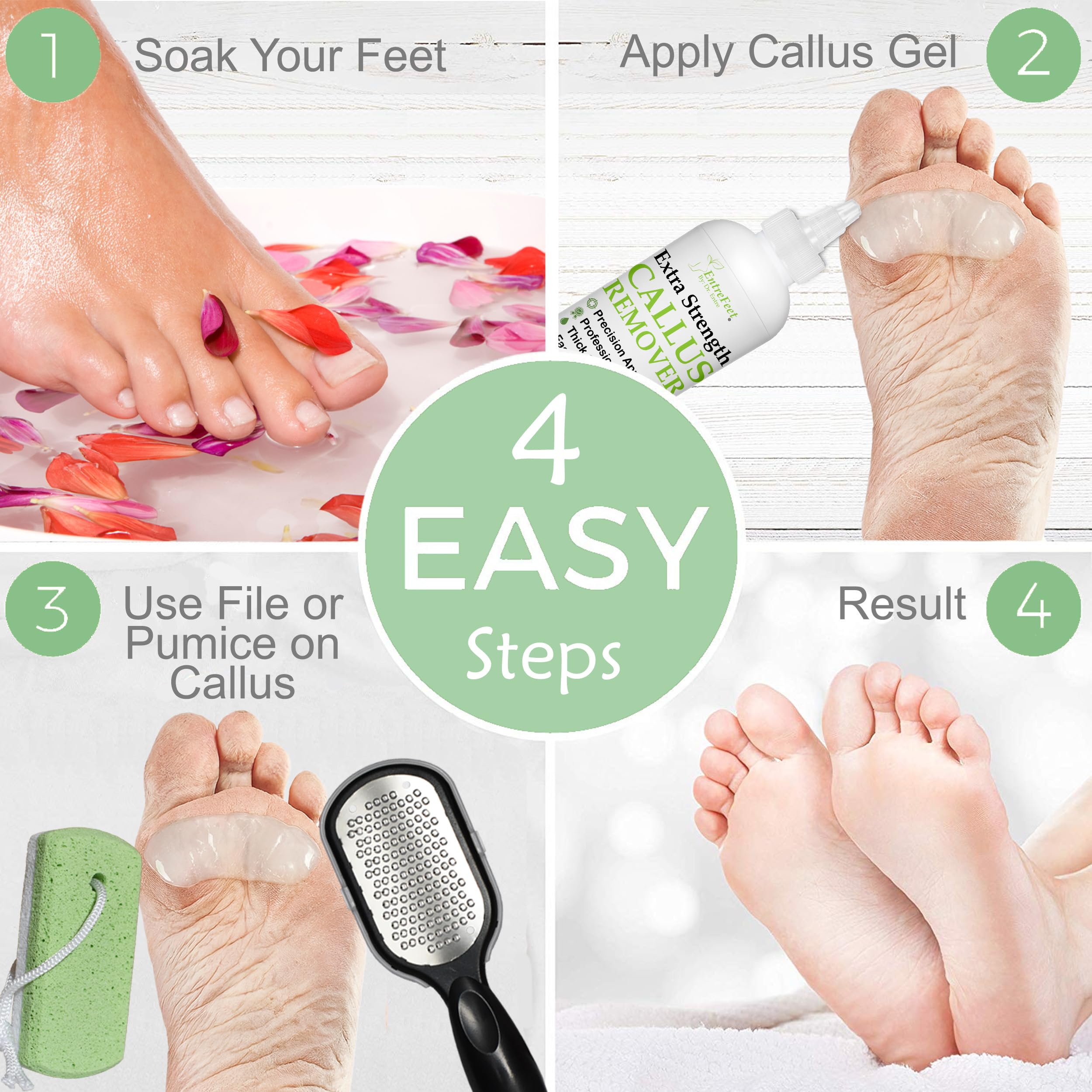 Amazon.co.jp: Dr. Entre's Callus Remover Kit for Feet: 8oz Callus